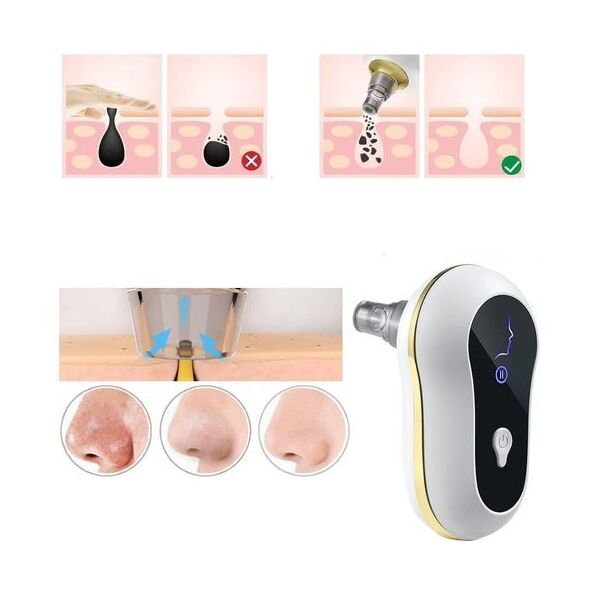 مزيل الرؤوس السوداء 4 في 1